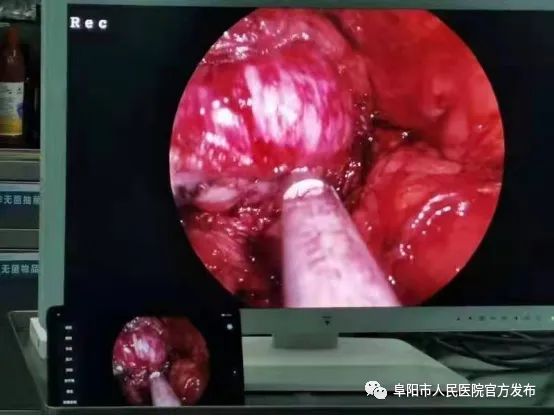 1655889475734703.jpg 640-3.jpg